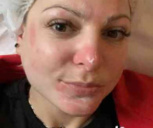 Magda Narożna zmasakrowana. Wygląda jak po walce bokserskiej [ZDJĘCIA]