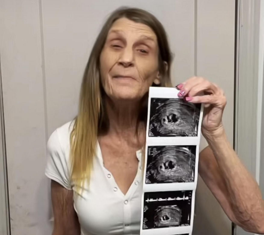 63-latka w ciąży! Urodzi dziecko 26-latka. Zobacz, jak razem wyglądają
