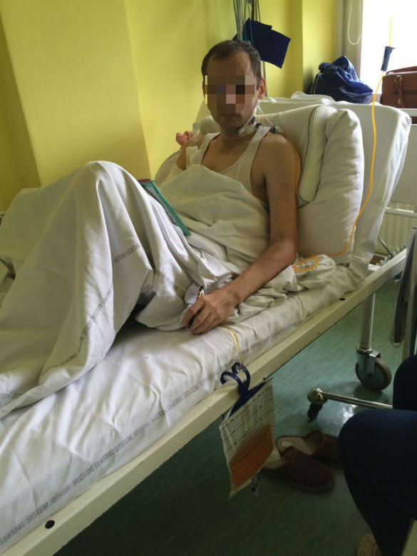Przez gips zgniła mi ręka