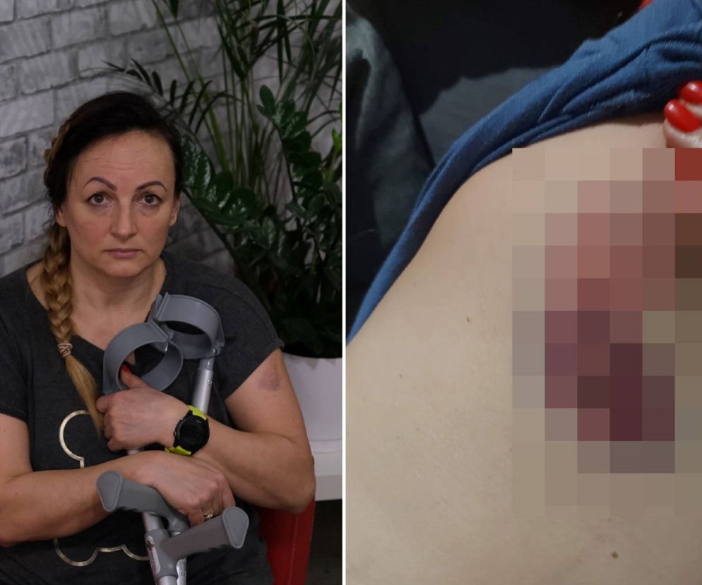 Mysłowice. Pies zaatakował panią Basię
