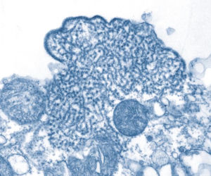 Wirus Nipah