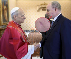 Tajemnicze blizny na głowie księcia! Zauważono je u papieża