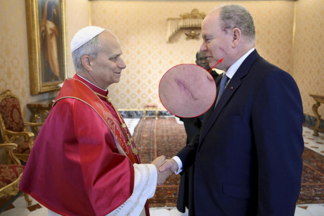 Tajemnicze blizny na głowie księcia! Zauważono je u papieża