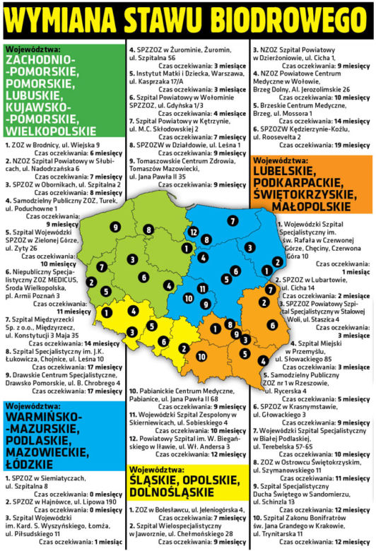 Tu nie czekasz na operację