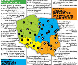 Tu nie czekasz na operację
