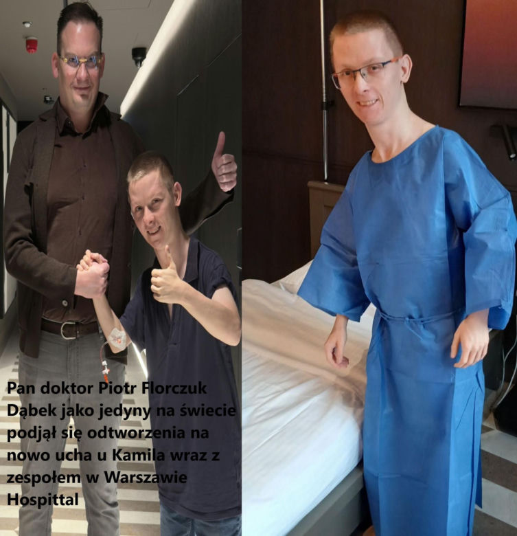 Kamil z Krakowa po latach walki ma nowe ucho. Nikt na świecie nie chciał się podjąć operacji
