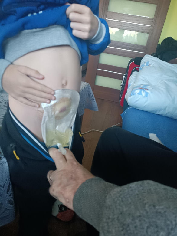 Ojciec wie, że umrze. Kto adoptuje 8-letniego Emilka z Siedlec?