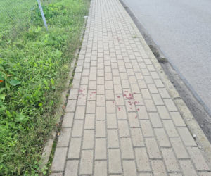 Leżajsk. Obciął dłoń maczetą [ZDJĘCIA]