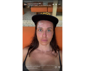 Gwiazda TVN poturbowana! Malwina Wędzikowska pokazała zakrwawioną twarz