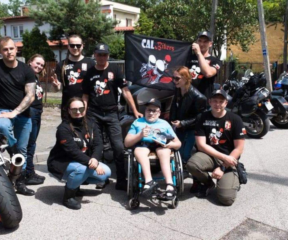 Gabryś przeszedł 17 operacji, tylko na twarzy i dłoniach nie ma blizn. Jego pają jest pomoc innym!