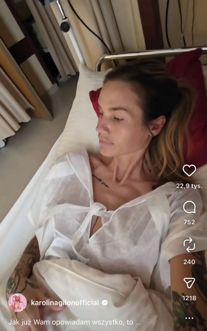 Karolina Gilon zoperowała biust. Zdjęcia przed i po