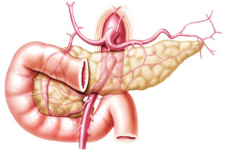 Cholangiografia – wsteczna, przezskórna, śródoperacyjna. Na czym polega?