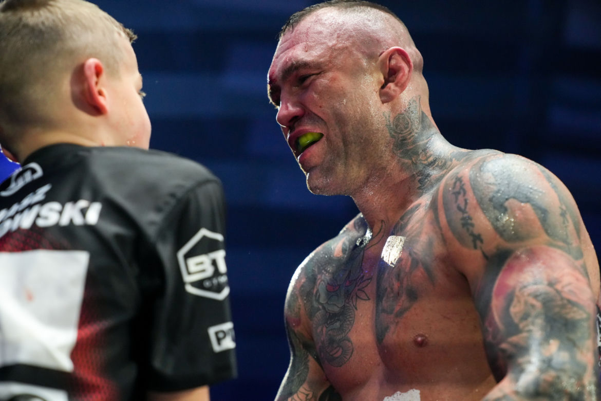 Paczuski: Potworne rozcięcie na twarzy gwiazdy KSW