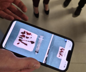 Pazurami wyrywaliśmy ją śmierci. Lekarze z Białegostoku cudem uratowali 36-letnią Justynę