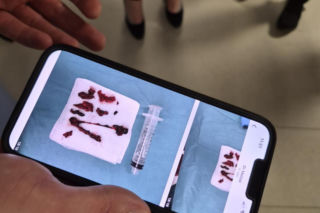 Pazurami wyrywaliśmy ją śmierci. Lekarze z Białegostoku cudem uratowali 36-letnią Justynę