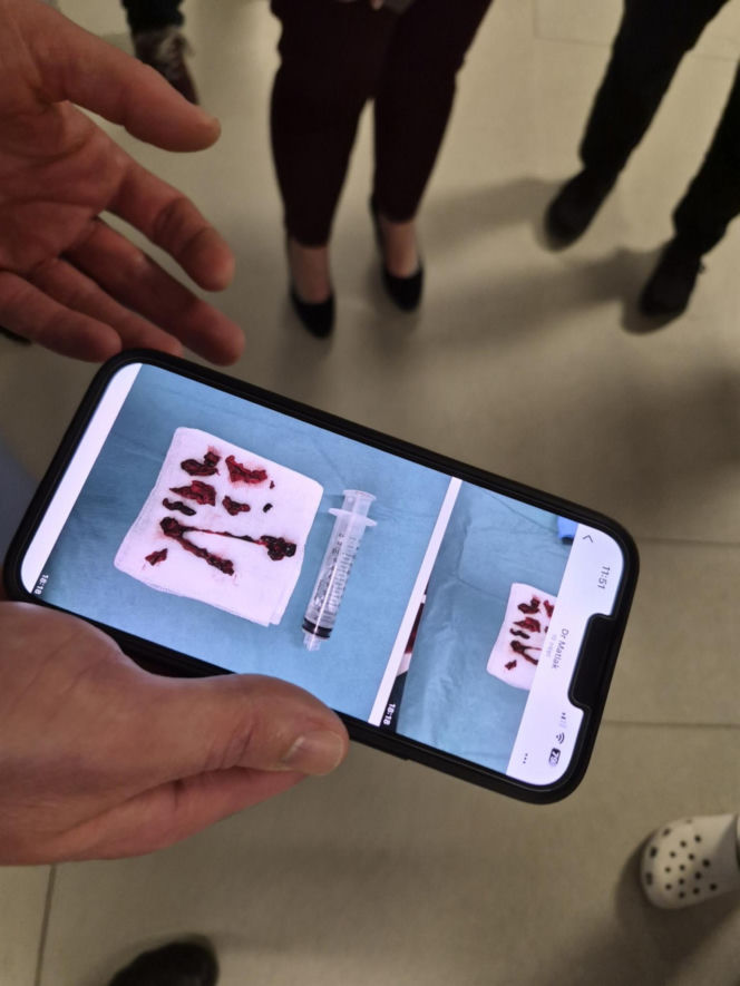 "Pazurami wyrywaliśmy ją śmierci". Lekarze z Białegostoku cudem uratowali 36-letnią Justynę