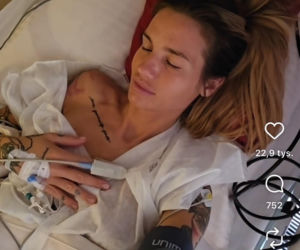 Karolina Gilon zoperowała biust. Zdjęcia przed i po