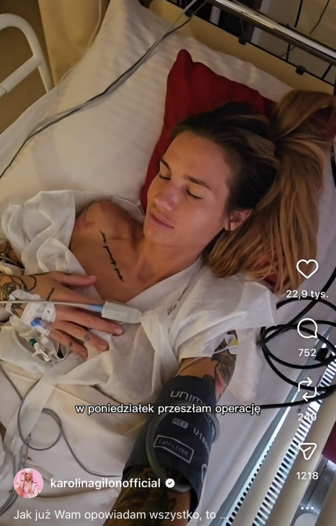 Karolina Gilon zoperowała biust. Zdjęcia przed i po