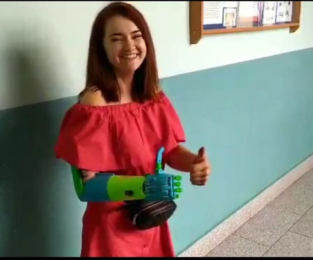 Koledzy wydrukowali Kindze kolejną rękę w 3D