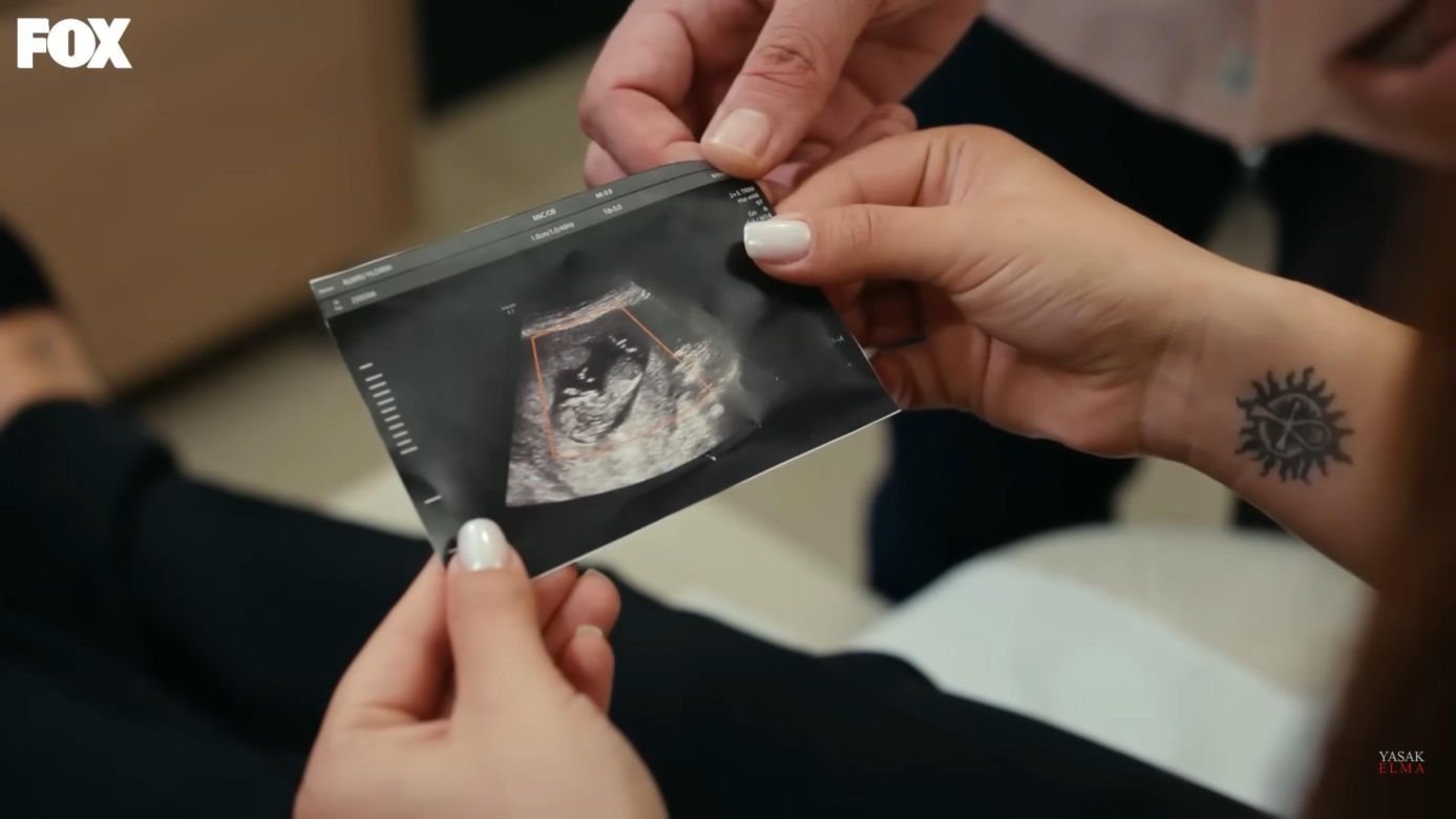 Zakazany owoc. Kumru i Caner razem na badaniu USG. Ujawniamy płeć dziecka!