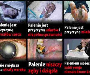 Ostrzeżenia zdrowotne