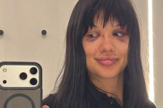 Dominika Rybak po walce
