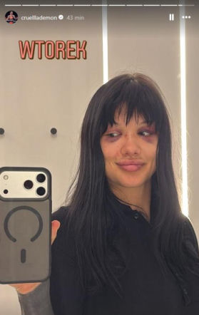 Dominika Rybak po walce