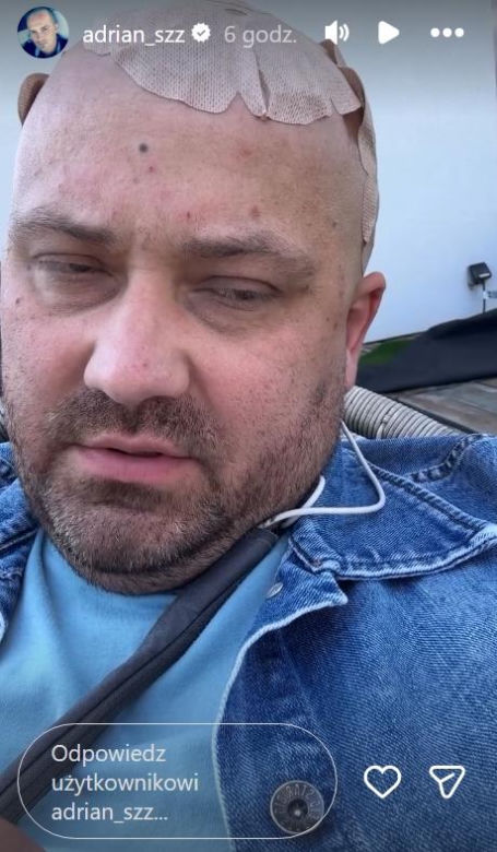 Adrian ze "Ślubu od Pierwszego Wejrzenia" ma obrzęk mózgu. Walczy też z podwójnym widzeniem