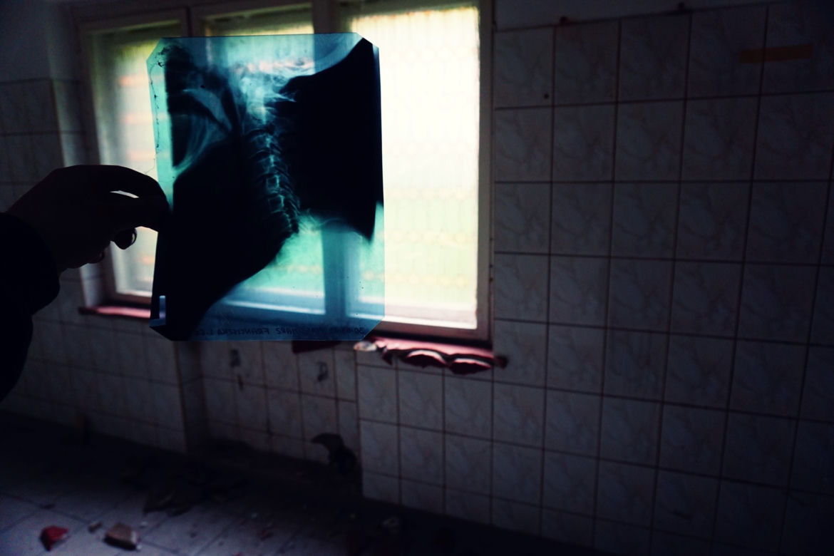 Opuszczony szpital rehabilitacyjny dla dzieci w Wielkopolsce [GALERIA]