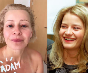 Małgorzata Kożuchowska podniosła policzki i wygładziła czoło