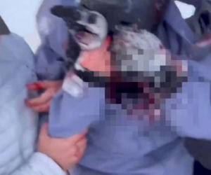 Horror na stoku. Narciarce krew się lała z twarzy. Zaatakował ją drapieżnik!