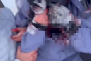 Horror na stoku. Narciarce krew się lała z twarzy. Zaatakował ją drapieżnik!