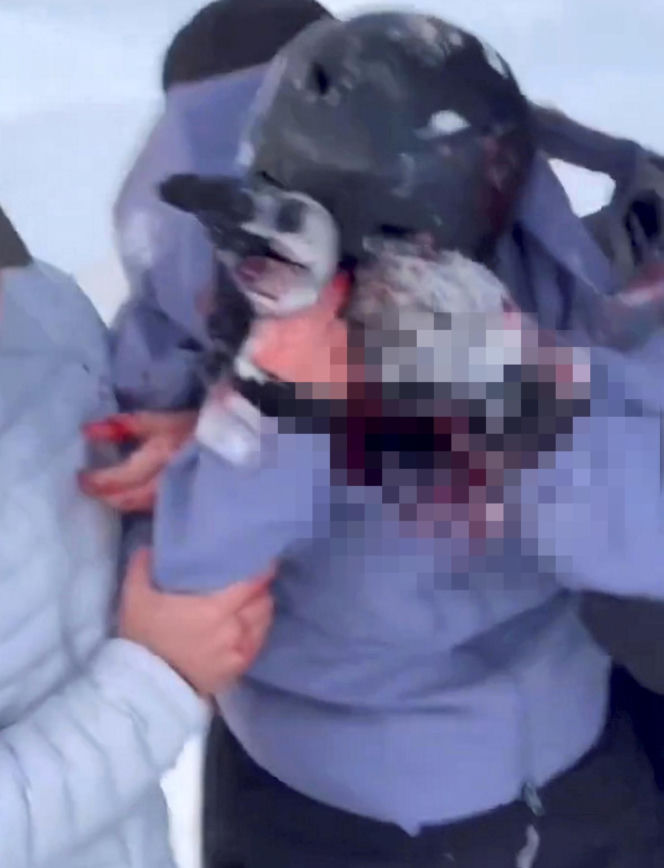 Horror na stoku. Narciarce krew się lała z twarzy. Zaatakował ją drapieżnik!