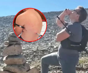 Nadział się na kijek trekkingowy i żyje! Szedł po pomoc 16 kilometrów