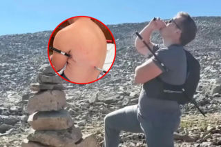 Nadział się na kijek trekkingowy i żyje! Szedł po pomoc 16 kilometrów