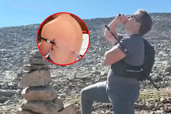 Nadział się na kijek trekkingowy i żyje! Szedł po pomoc 16 kilometrów