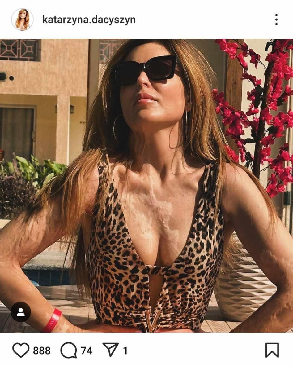 Katarzyna Dacyszyn