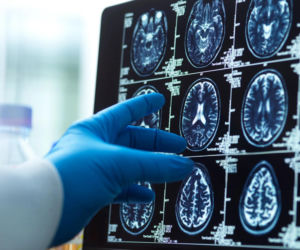 Przełomowe odkrycie w badaniach nad chorobą Alzheimera. Naukowcom udało się odwrócić objawy