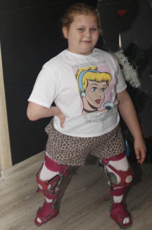 Czołgam się, bo nie mamy na ortezy