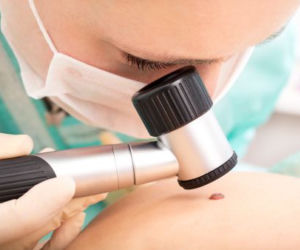 Jakie badania wykonuje dermatolog