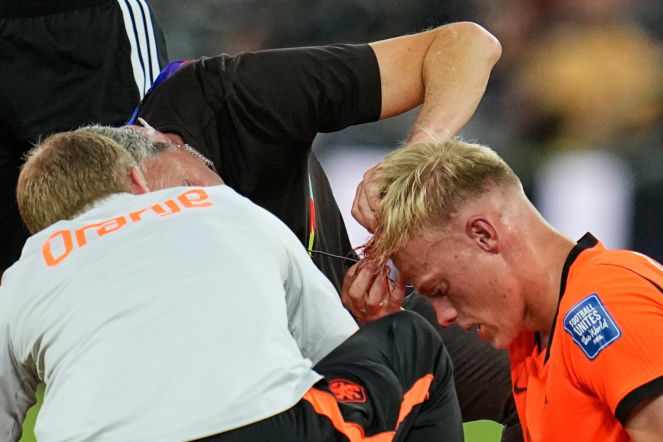 Polała się krew na mundialu! Mocne obrazki podczas meczu Holandii z Marokiem