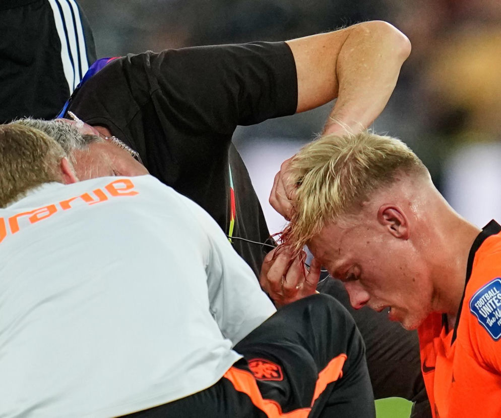 Koszmarny wypadek podczas meczu MŚ. Obrońca Oranje zalał się krwią na murawie