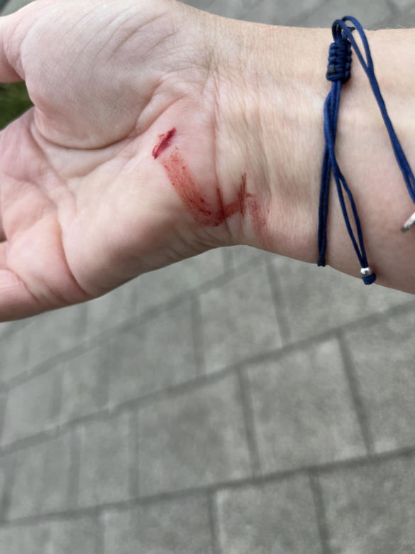 Kobieta pobita przez staruszka, bo zwróciła mu uwagę. "Przewrócił mnie na chodnik i okładał parasolką, potem uderzył pięścią w twarz"