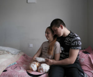 Oksana straciła obie nogi i cztery palce. Jej zdjęcia wzruszają do łez