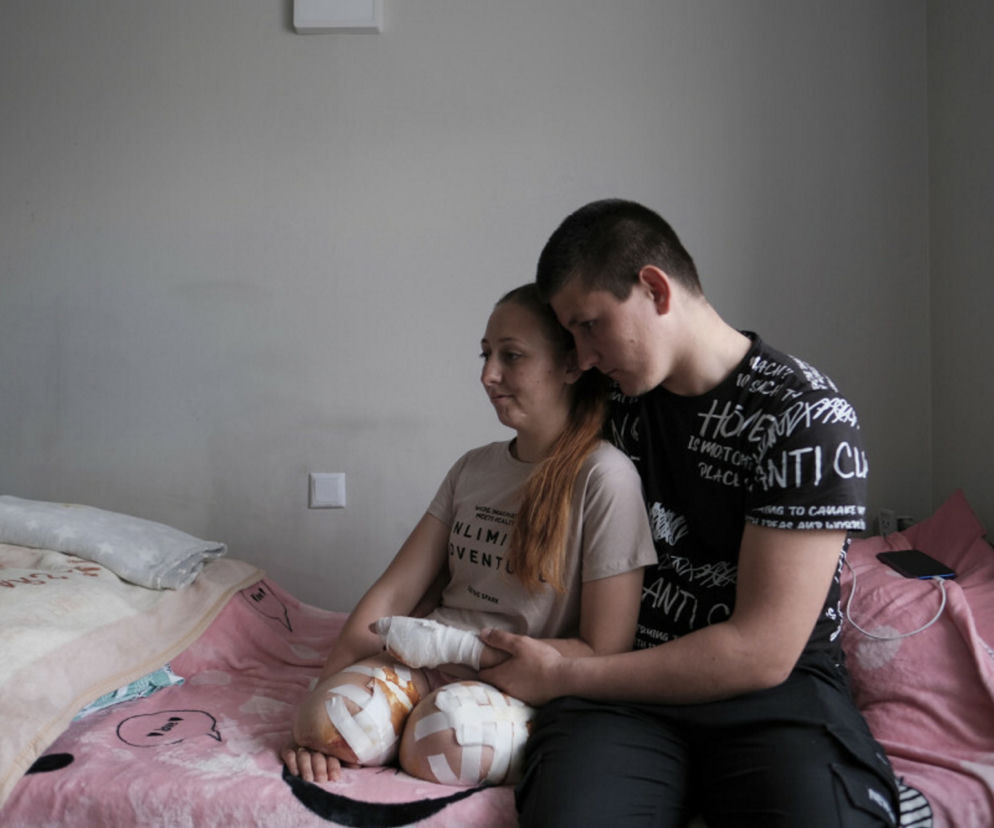 Oksana straciła obie nogi i cztery palce. Jej zdjęcia wzruszają do łez