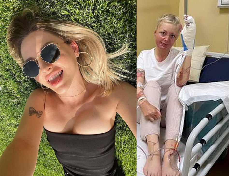 Maja Kuczyńska przeżyła piekło. Całe ciało w oparzeniach