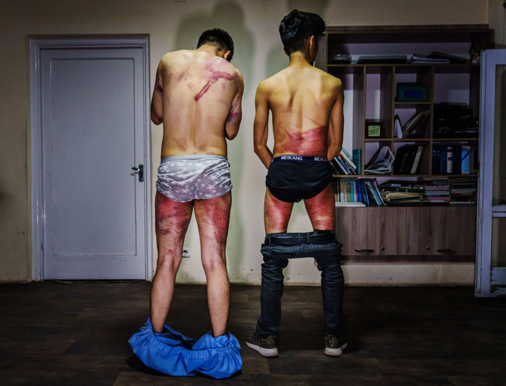 Bestialski atak na dziennikarzy! Talibowie są bezwzględni [DRASTYCZNE ZDJĘCIA]