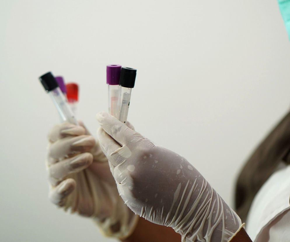 Próbki laboratorium