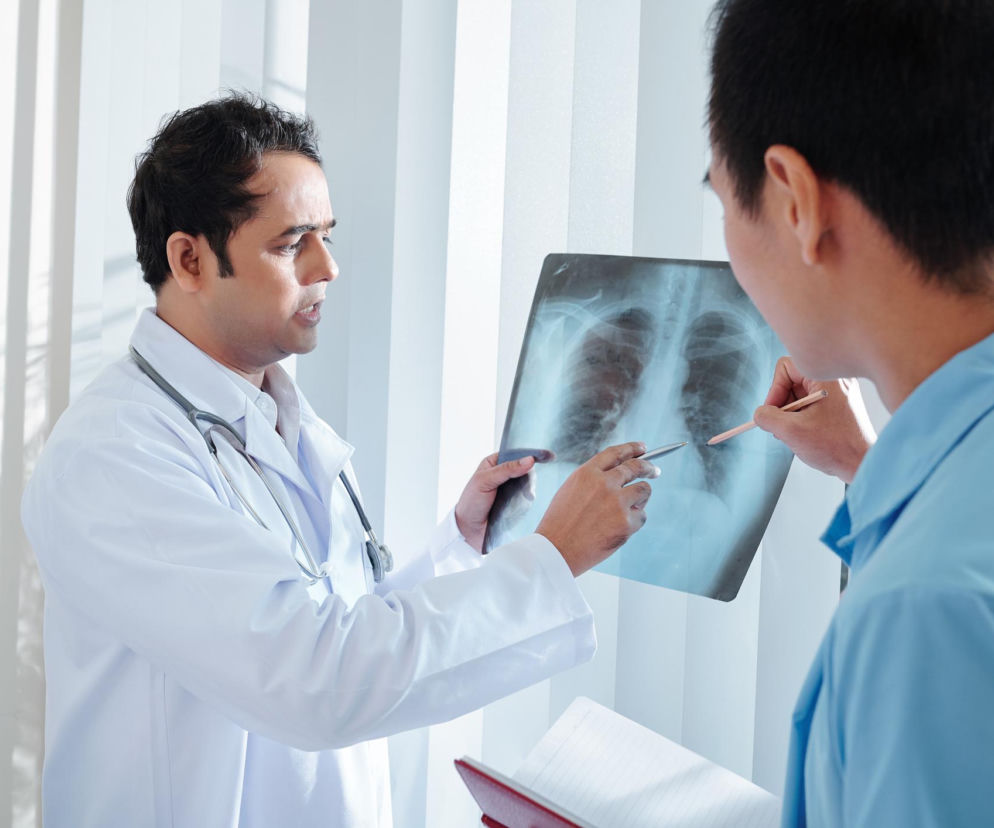 Lekarz w białym kitlu ze stetoskopem na szyi omawia zdjęcie rentgenowskie płuc z pacjentem, wskazując na zmiany. Obaj skupieni są na obrazie, co ilustruje temat diagnostyki raka płuc. Więcej o objawach raka płuc przeczytasz na Poradnik Zdrowie.