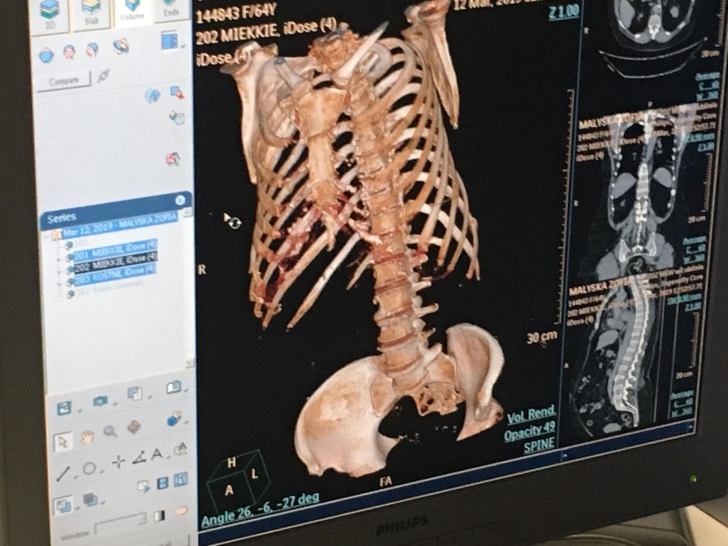 Nowy sprzęt w szpitalu MSWiA w Lublinie. Pomoże zdiagnozować pacjentów